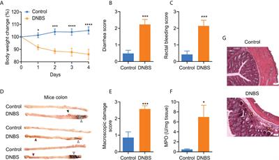 TNF-α enhances sensory DRG neuron excitability through modulation of P2X3 receptors in an acute colitis model